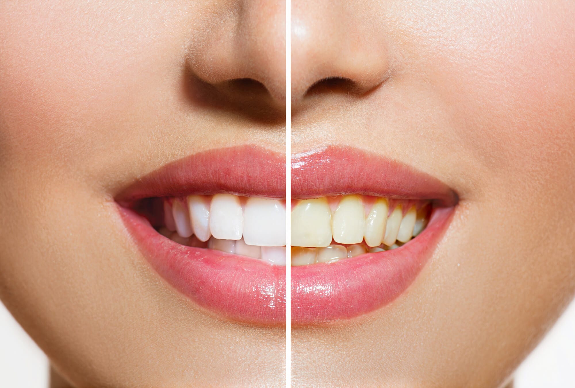 Tips to Keep Your Teeth Healthy : NewtonsBaby.com